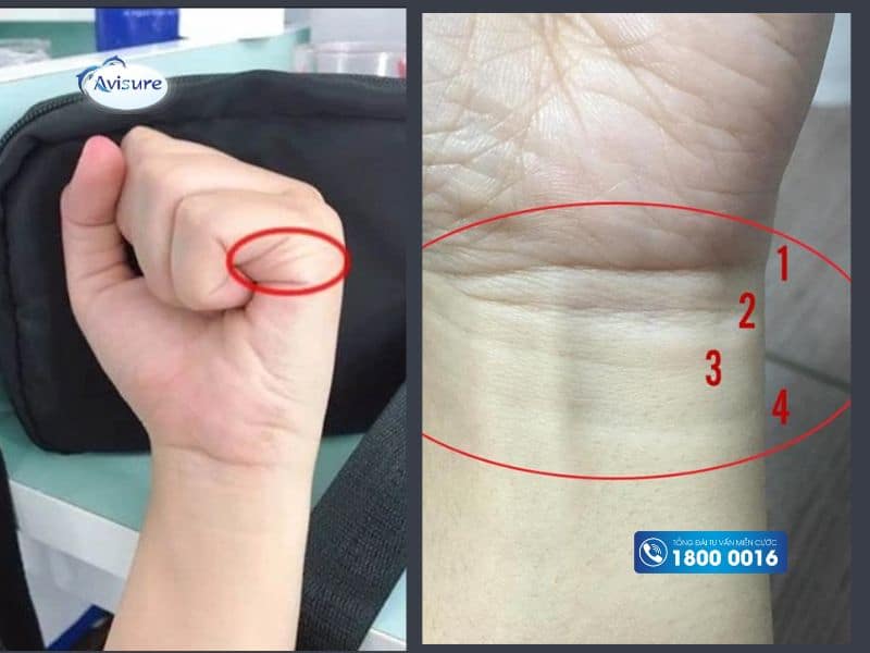 Đường chỉ tay liên quan tới con cái
